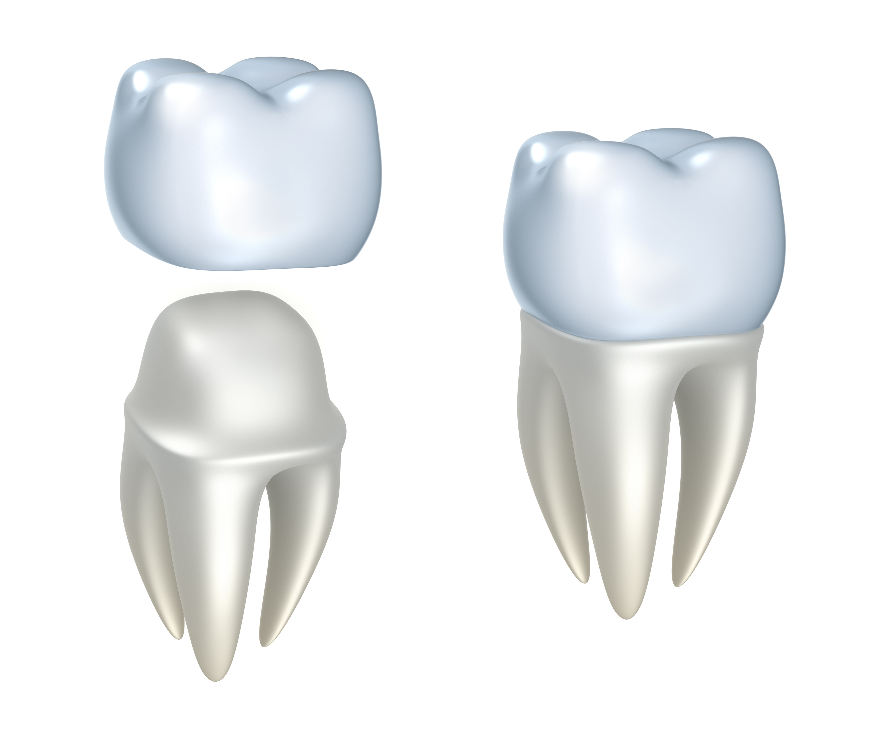 Dental Crowns and Tooth