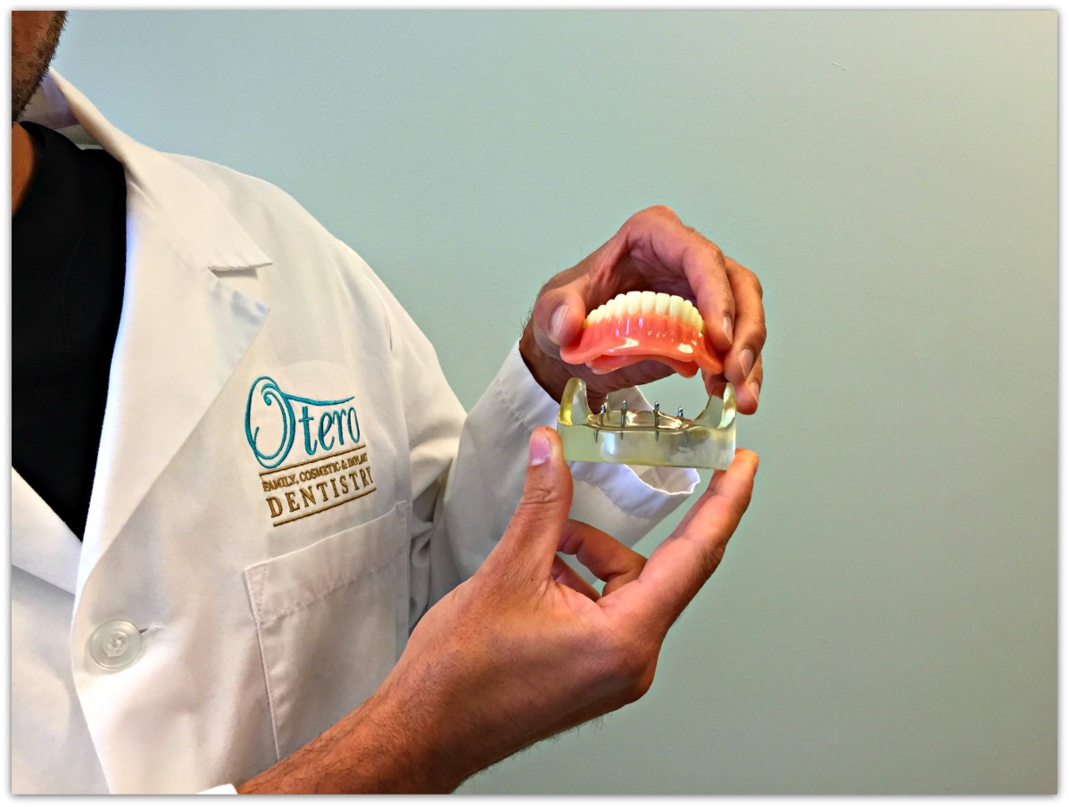 Otero Dentist Mini Implant
